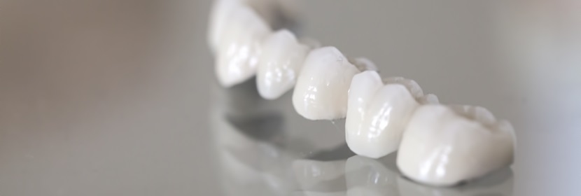 精細(xì)陶瓷粘結(jié)強度試驗