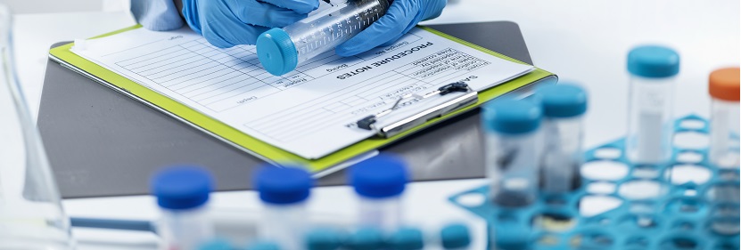 酚醛模塑料用酚醛樹脂檢測(cè)