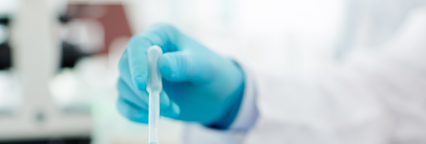 環(huán)氧乙烯基酯樹(shù)脂檢測(cè)